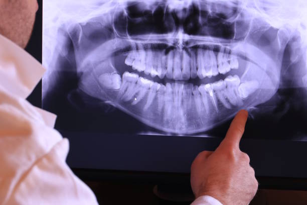 Best Emergency Dentist for Lost Fillings or Crowns in Eagle Grove, IA