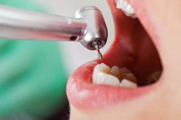 Best Emergency Dental Services for Seniors in Eagle Grove, IA